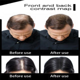 Hair Fibers Keratin Thickening Spray Hair Fibers 27.5g Loss Regrowth Powders - Khalesexx