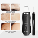 Khalesexx Ultrasonic Ion Deep Cleaning Skin Scrubber Peeling Shovel Facial Pore Cleaner